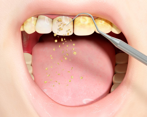 smiley-dental-beverly-periodontal-mobile