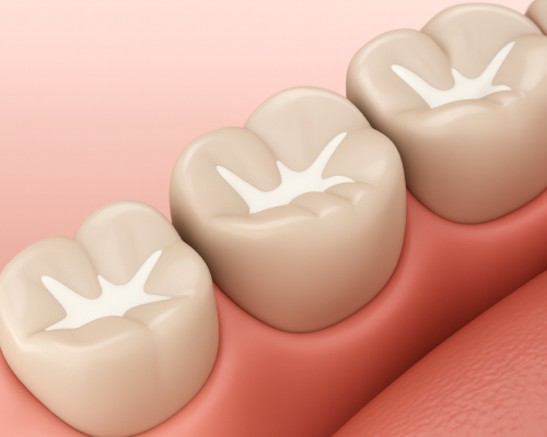 smiley-dental-beverly-sealants-mobile