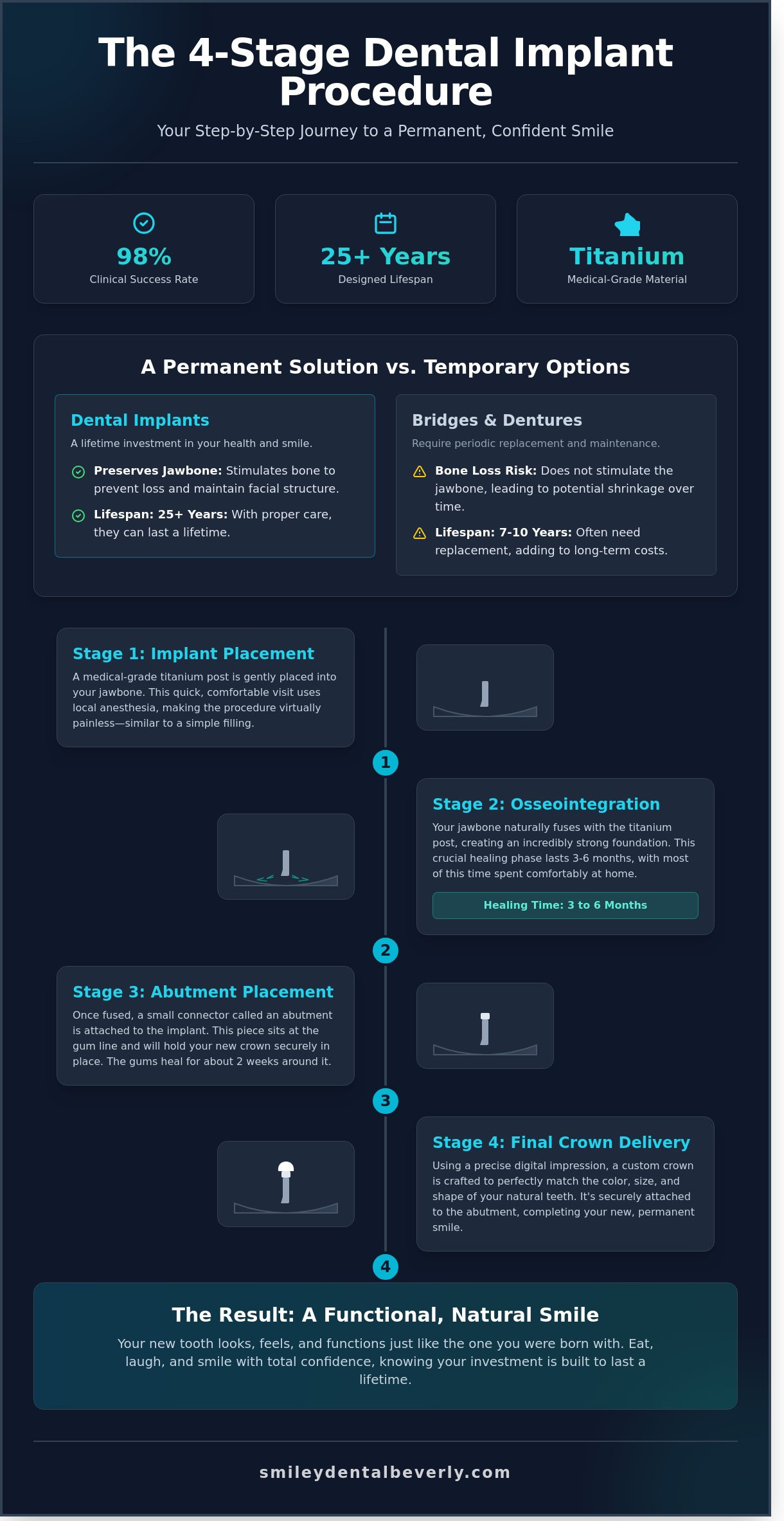 Step-by-Step Dental Implant Procedure in Beverly, MA: Your 2026 Guide
