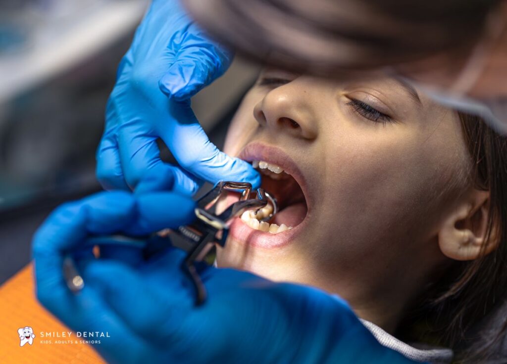 Pediatric dentist applying a tooth-colored filling on a young patient's molar at Smiley Dental